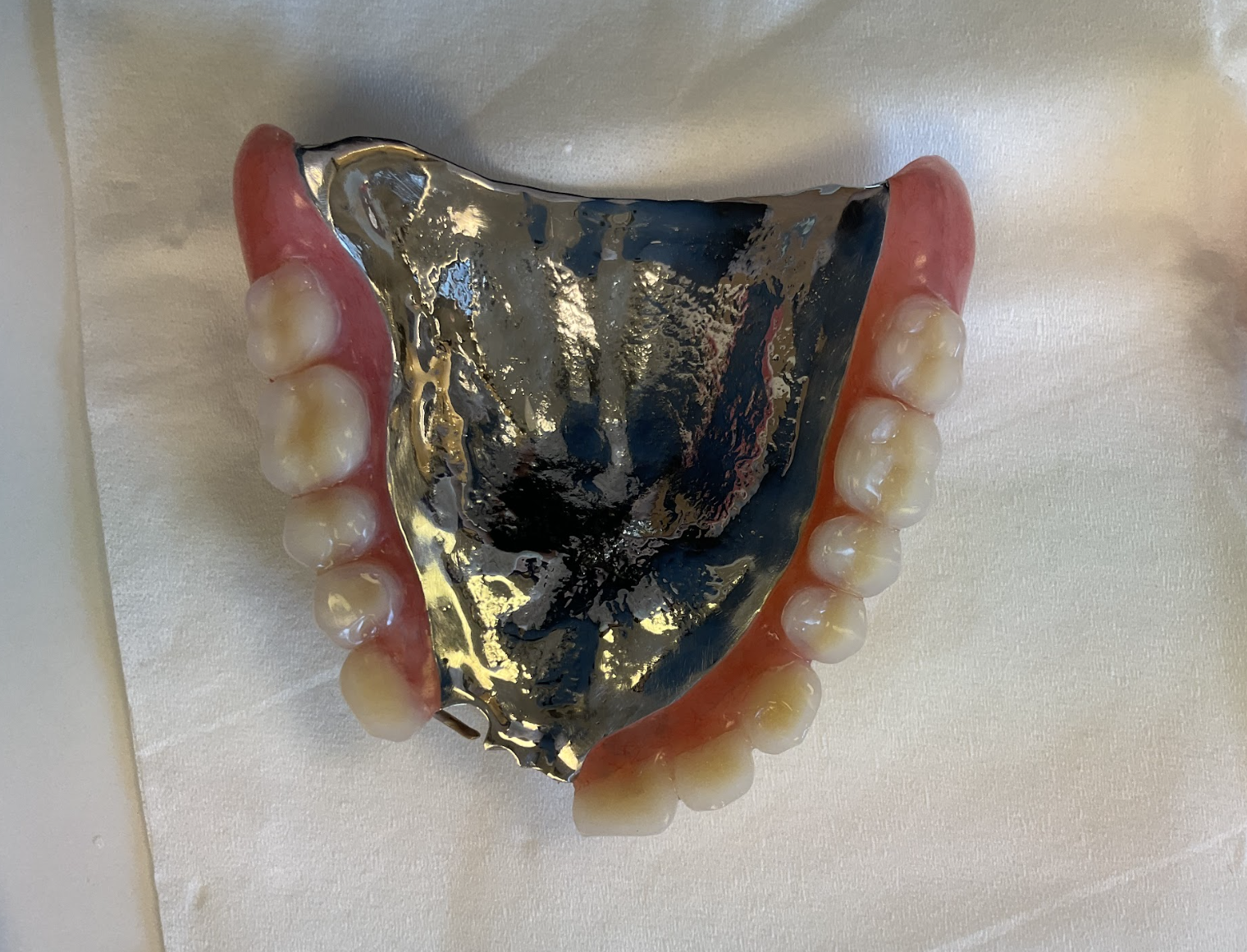 プレミアムデンチャーの比較画像